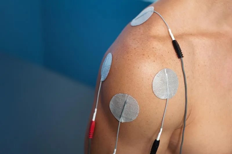 Electrical Stimulation<br />